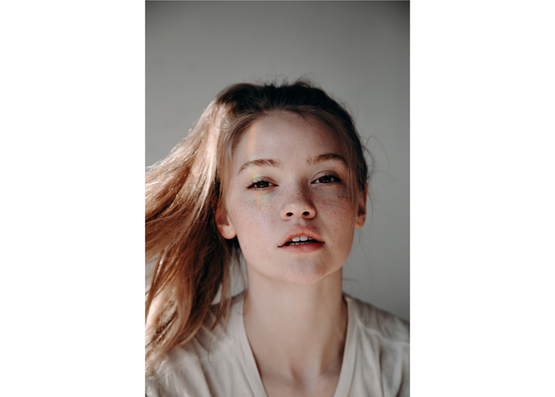 Личный опыт: как избавиться от постакне.